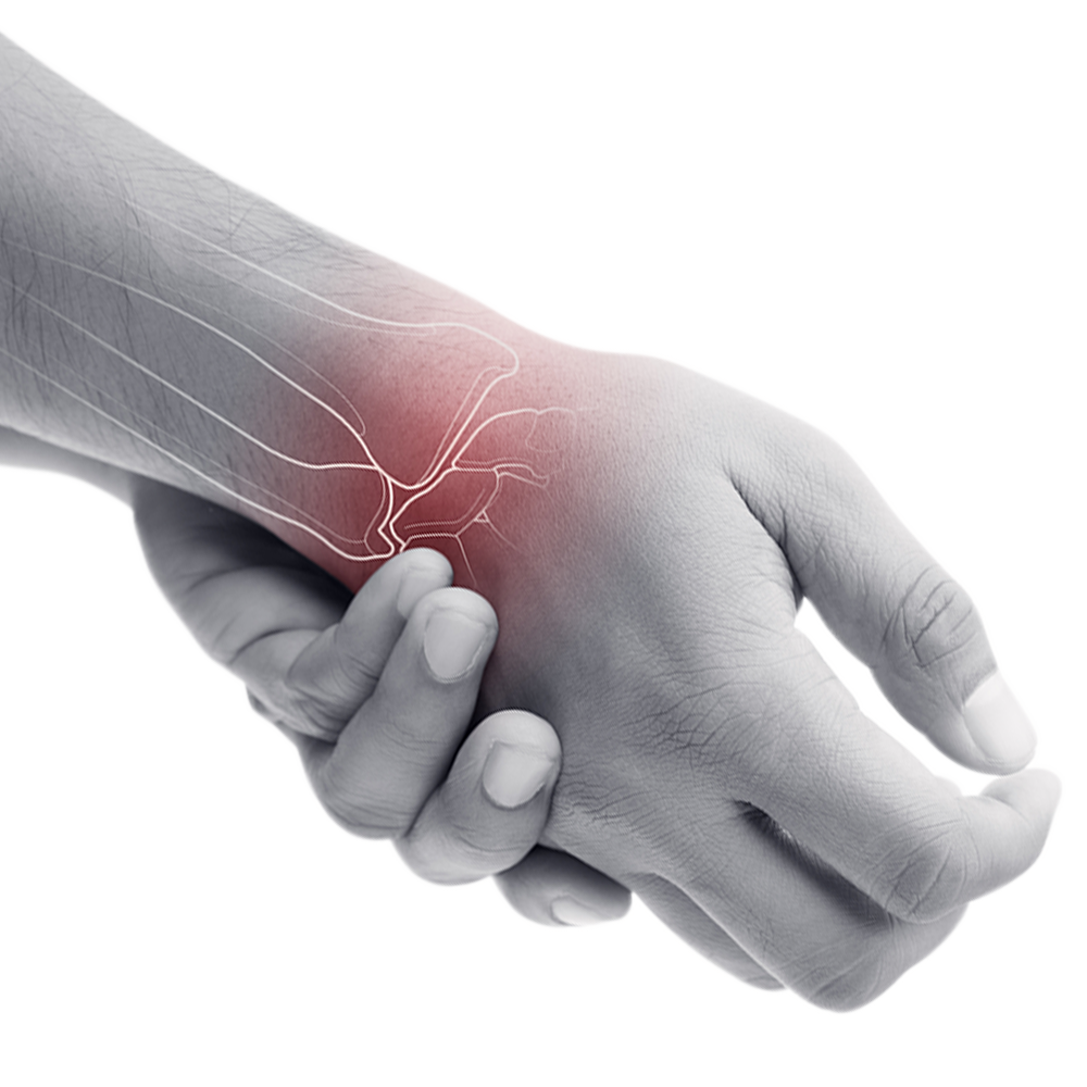 Illustration of a wrist with a red highlighted painful area and tendons